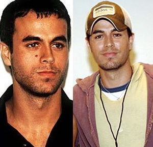 Cancerous Mole Removal