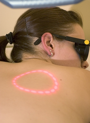 Mole Removal in Scotland