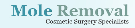 Mole Removal