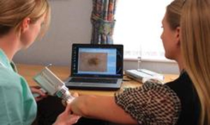 Private Mole Removal